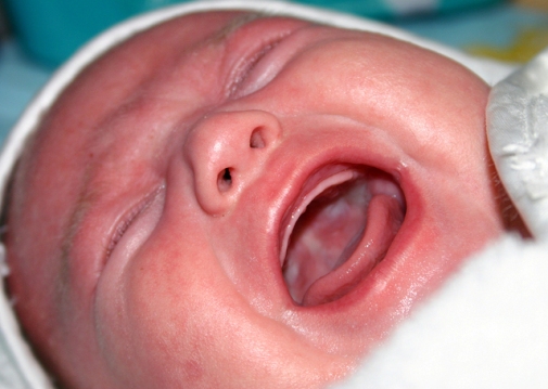 plakanje i zacenjivanje novorodjenceta